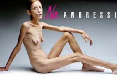 Isabelle Caro, anorexie, morte, combat, maladie, actrice, Oliviero Toscani, poser nue, sensibilisation,