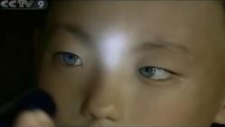 enfant, yeux de chat, voir dans le noir, insolite, Nong Youhui, yeux bleus, très lumineux, médecin, briller, épreuve de lecture, hôpital de Dahua, pigmentation, leucodermie,
