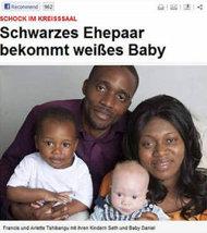 Un bebe blanc nait de parents noirs