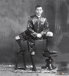 homme aux 3 jambes, Francesco Lentini, insolite, Sicile, attachée, colonne vertébrale, malformation, jumeau parasite, ventre de sa mère, abandonné, rejeté, traité de monstre,