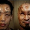 les bagelheads, nouveau, phénomène, underground, Japon, insolite, injecter, sous la peau, sérum physiologique, surprenant, risques d'infections, modification corporelle,